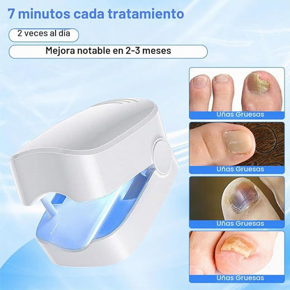 NailCare Pro - Dispositivo de Cuidado de Uñas con Luz LED💅