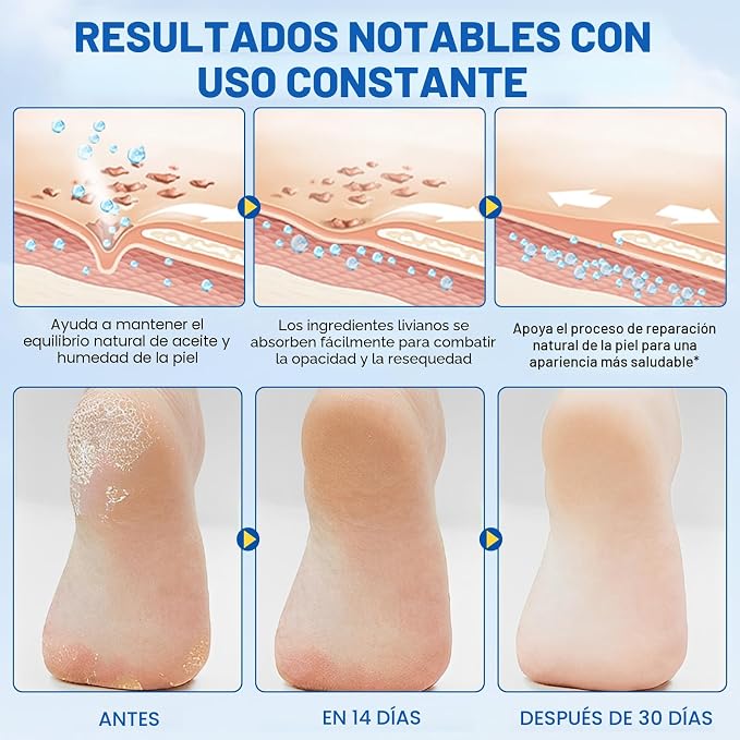 PediSoft 60™ — Barra Intensiva para Pies + Medias