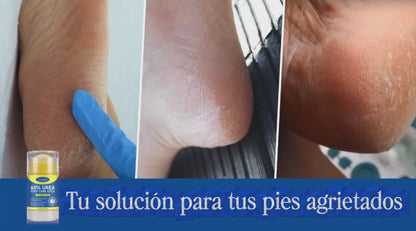 PediSoft 60™ — Barra Intensiva para Pies + Medias